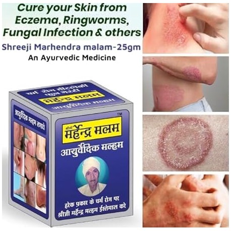 Ayurvedic Malam Cream for Anti-Fungal Infection, Itching & Skin Recovery for All Skin Types 25gm