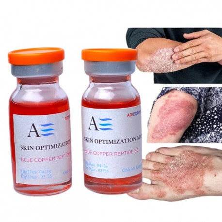 Anti fungal- Cream itching Eczema & Fungal,itching Cream For Skin Khaj Khujli Itch Coat fungal