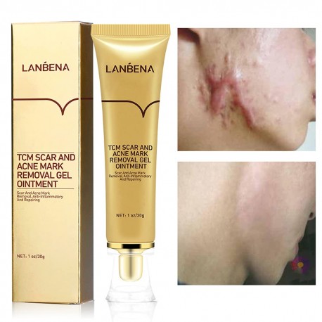 LANBENA Acne Scar Removal Stretch Marks Face Skin Whitening Repair Cream  30 ml