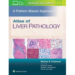 ATLAS OF LIVER PATHOLOGY A PATTERN BASED APPROACH (HB 2020) Hardcover